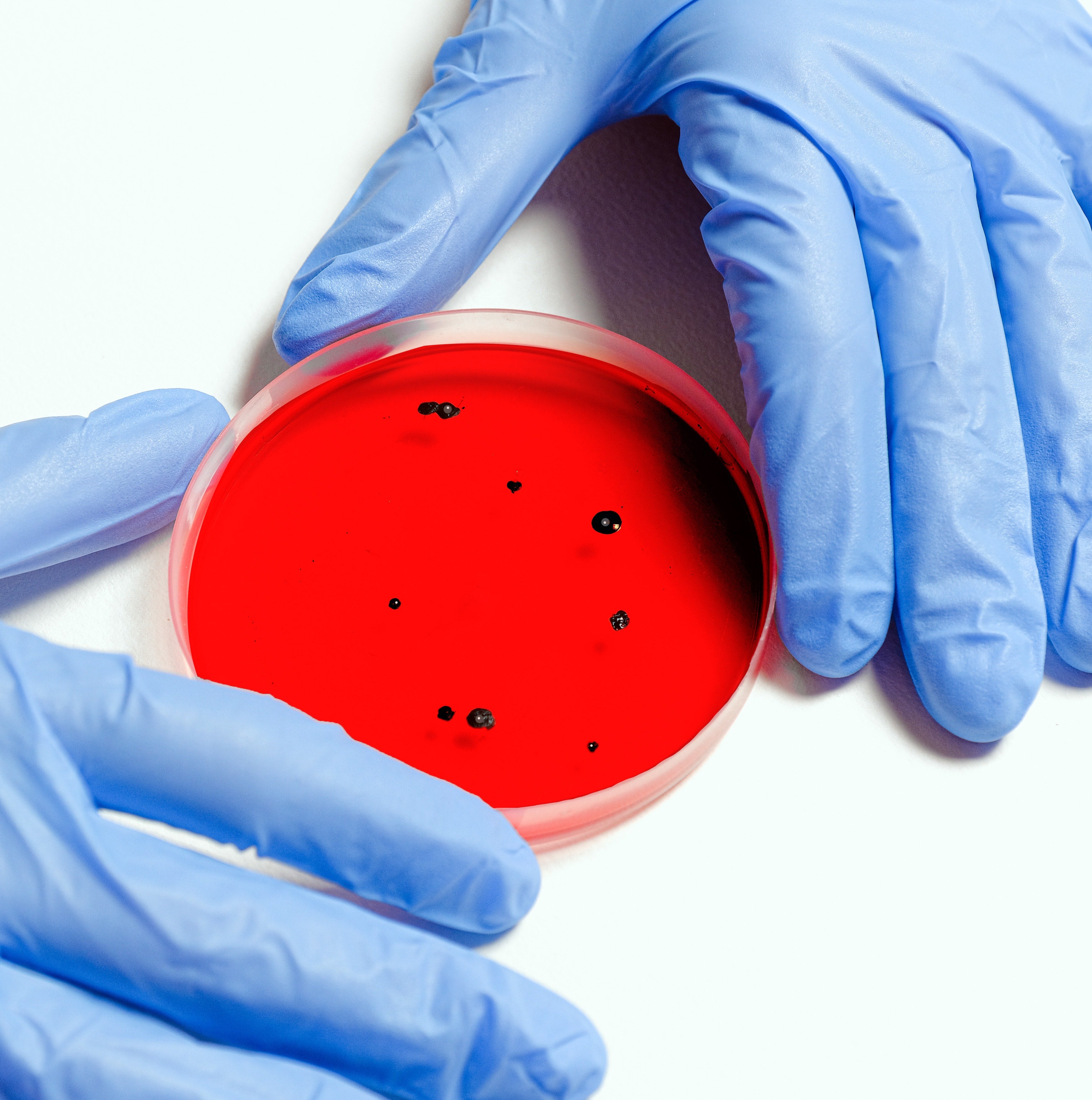 Laboratory Technician Works with Samples to Test for Microbiological Contaminations Such as Yeast Mold Salmonella Escherichia coli or Staphylococcus aureus